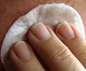 4 Great Essential Oils for Skin Tags | Get Rid of Skin Tags