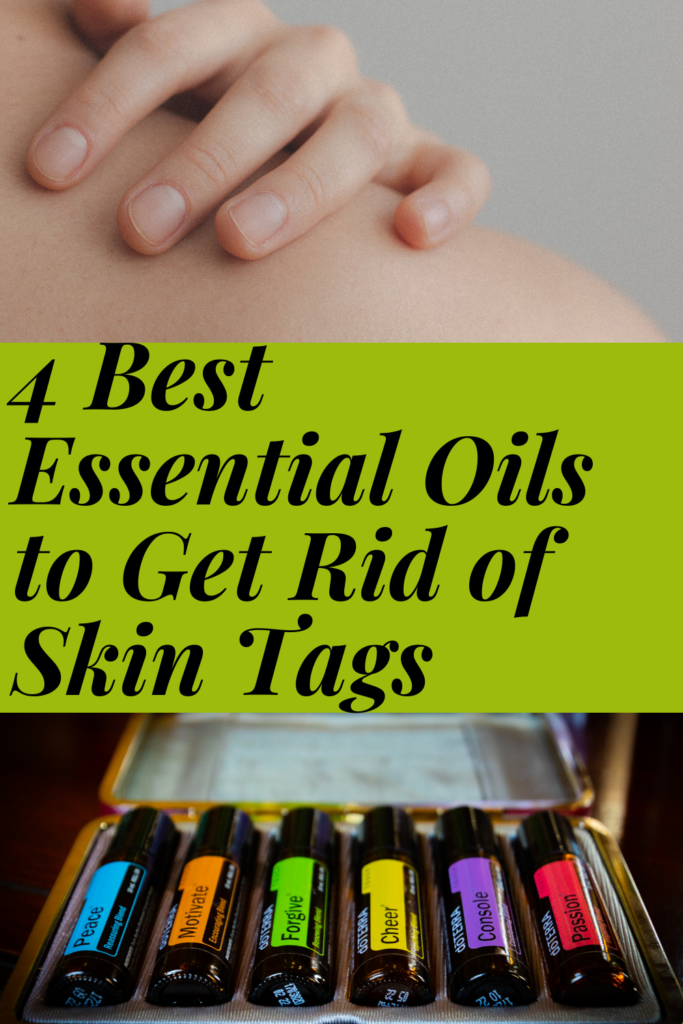 Best esssential oils for skin tags