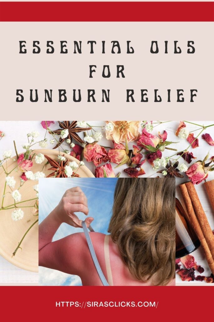 what essential oil is good for sunburn relief