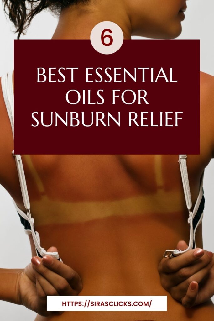 Best Oils for Sunburn