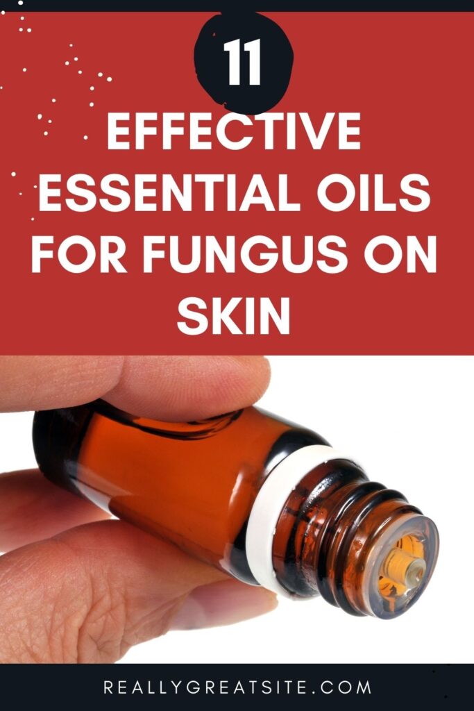 skin fungus essential oils