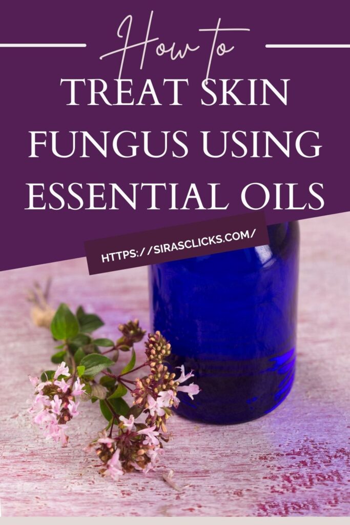 essential oils for skin fungal infection